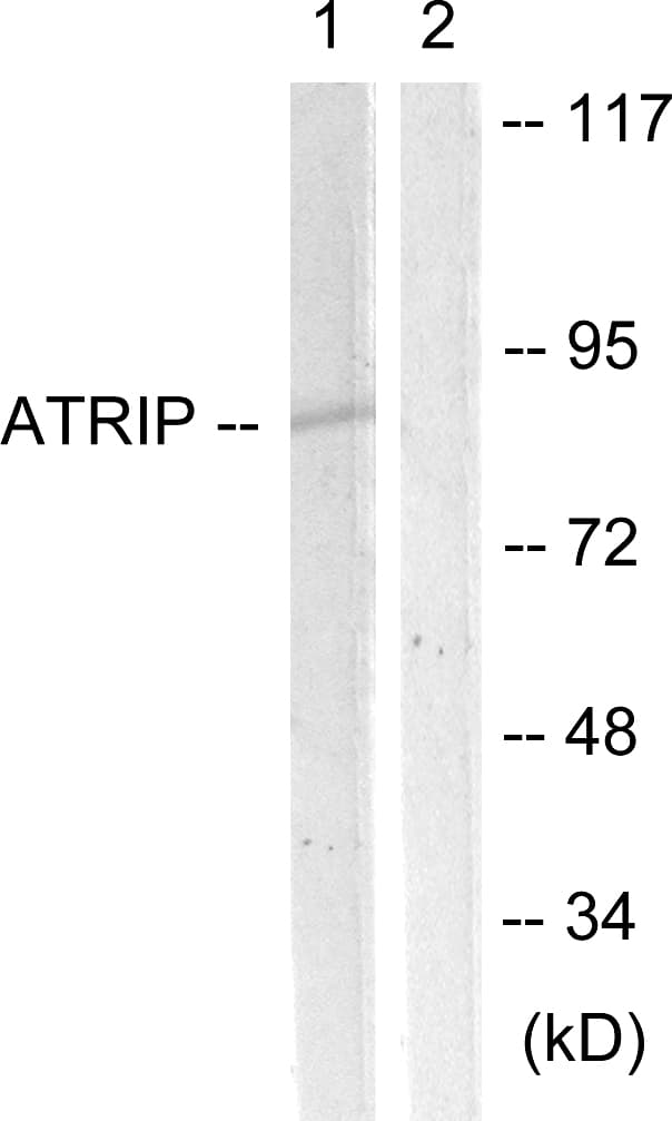 ATRIP Antibody (aa34-83)