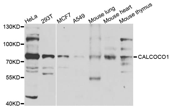 Polyclonal Rabbit anti-Human CALCOCO1 / CoCoa Antibody (IHC, IF, WB)