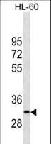 MMP26 Antibody (aa96-125)