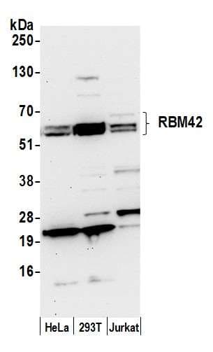 RBM42 Antibody (aa430-480)