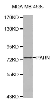 Polyclonal Rabbit anti-Human PARN Antibody (WB)