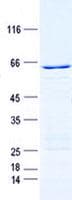 Human CDKL1 Protein (Recombinant GST, N-terminus + His, C-terminus)