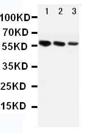 AGT / Angiotensinogen Antibody (aa25-36)