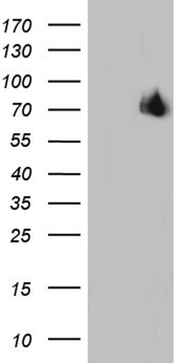 Monoclonal Mouse anti-Human ER Alpha / Estrogen Receptor Antibody (clone OTI8E9, aa1-310, IHC, WB)
