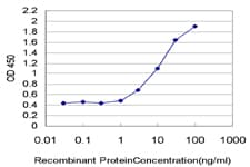 COUP-TFII / NR2F2 Antibody (clone 1D8)
