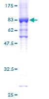 Human GK / Glycerol Kinase Protein (Recombinant GST)