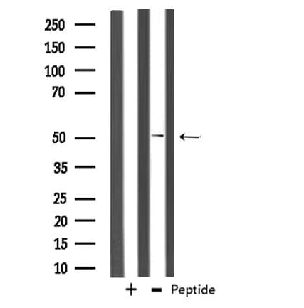 Polyclonal Rabbit anti-Human ADCK3 / CABC1 Antibody (IF, WB)