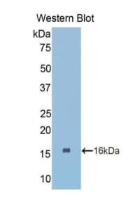 CTGF Antibody (aa80-200)