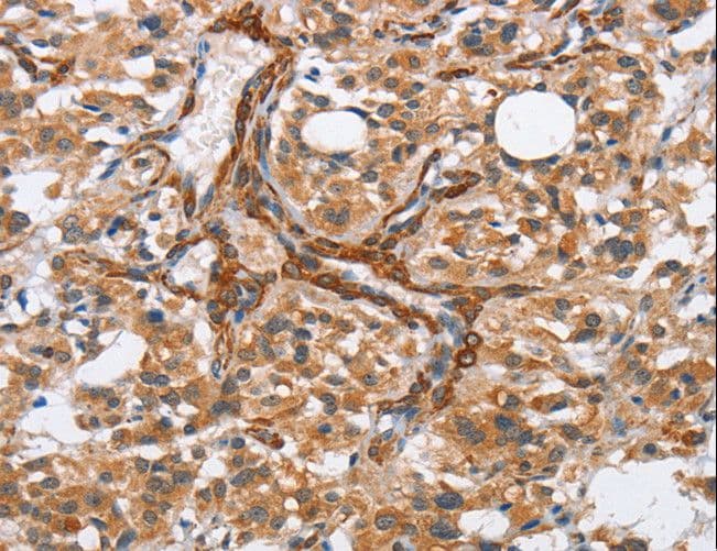 Polyclonal Rabbit anti-Human BUB1 Antibody (IHC)
