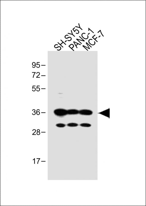 Polyclonal Rabbit anti-Human OR5V1 Antibody (C-Terminus, WB)