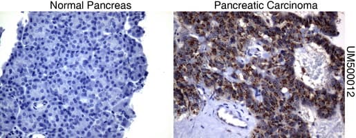 Monoclonal Mouse anti-Human SQSTM1 Antibody (clone UMAB12, Carrier-free, IHC, IF, WB)