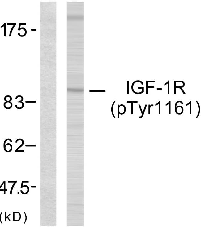 IGF1R / IGF1 Receptor Antibody (phospho-Tyr1161)