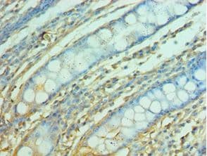FRA-1 / FOSL1 Antibody (aa1-100)