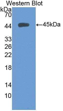 KRT5 / CK5 / Cytokeratin 5 Antibody (aa166-474)