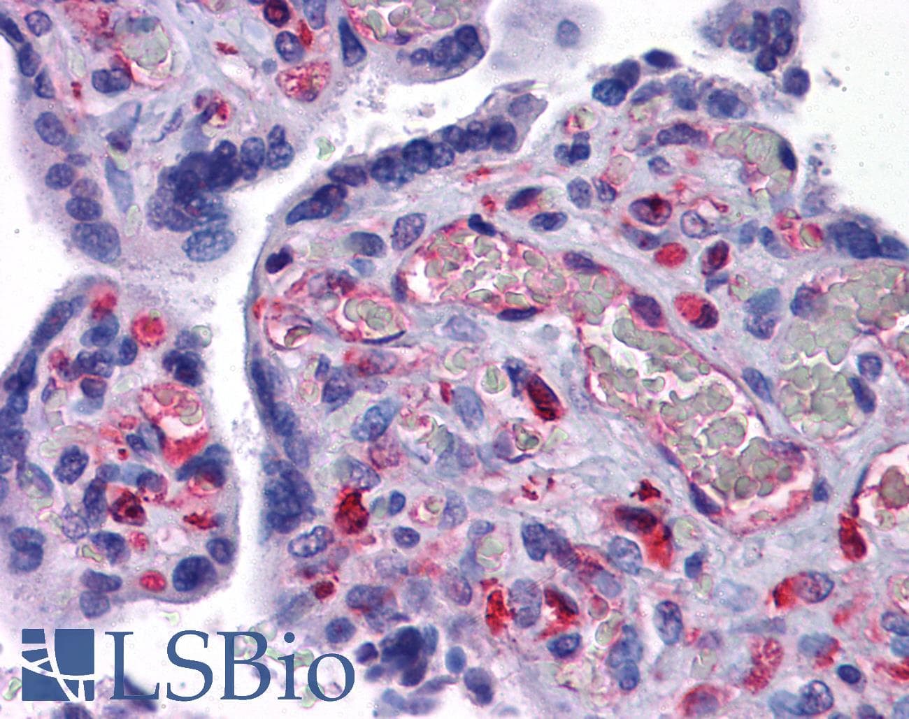 IHC-plus™ CRACR2A / EFCAB4B Antibody