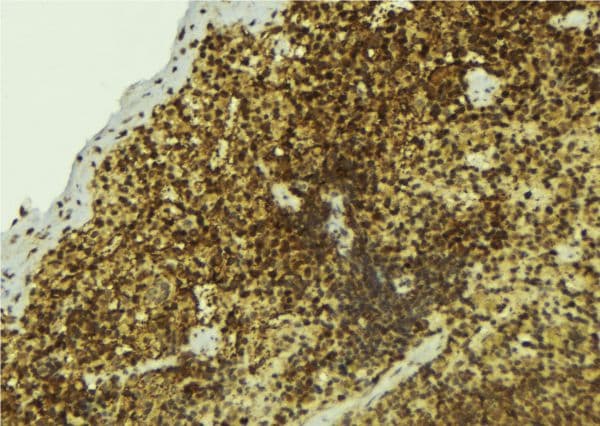 NONO / P54NRB Antibody