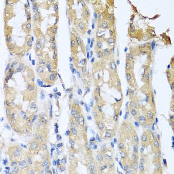 Polyclonal Rabbit anti-Human CCL3 / MIP-1-Alpha Antibody (IHC, WB)