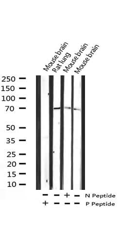 p66 / SHC Antibody (phospho-Tyr427)