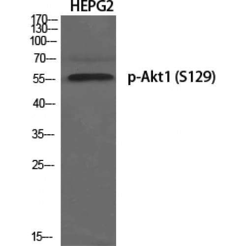 AKT1 Antibody (70-150 aa)