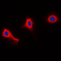 NCF1 / p47phox / p47 phox Antibody (phospho-Ser370)