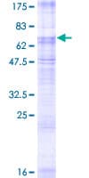 Human SLC2A8 / GLUT8 Protein (Recombinant GST)