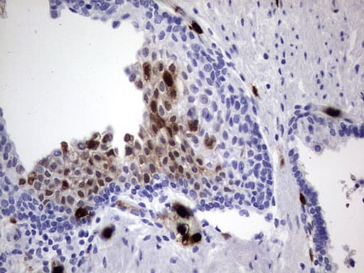 S100A9 / MRP14 Antibody (clone OTI3C12)