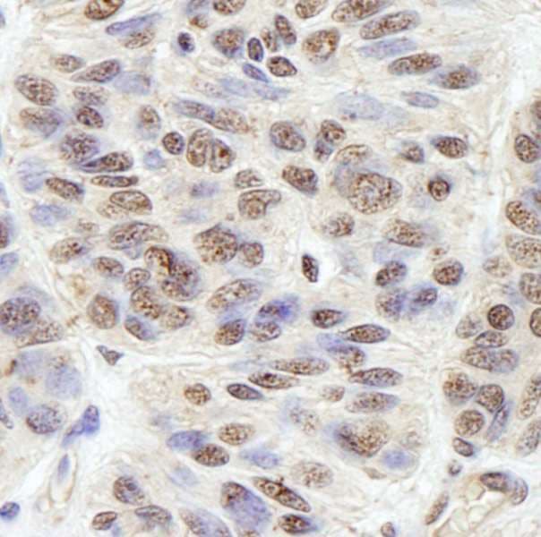 BLAP75 / RMI1 Antibody (aa275-300)