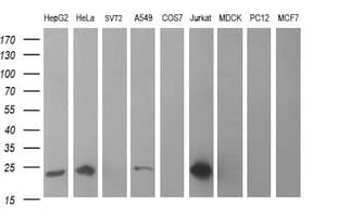 Monoclonal Mouse anti-Human BID Antibody (clone OTI3E6, WB)