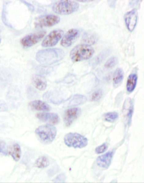 Polyclonal Rabbit anti-Human CDK11A / CDC2L2 Antibody (aa730-C-term, IHC, WB)