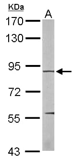 EEF2K Antibody (aa1-268)