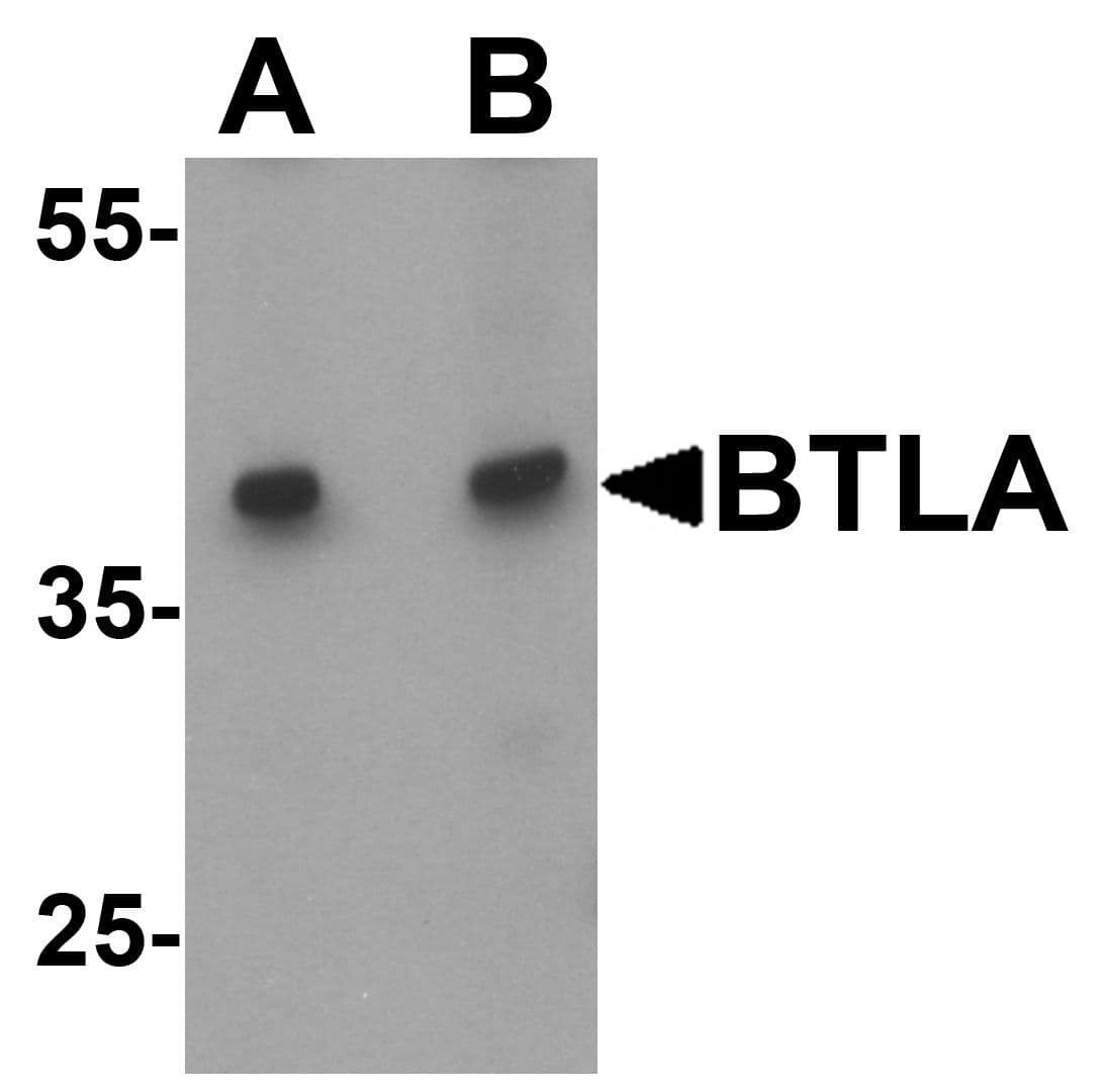 BTLA / CD272 Antibody