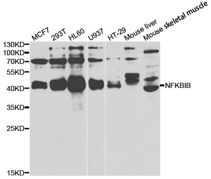 Polyclonal Rabbit anti-Human NFKBIB / IKB Beta / IKBB Antibody (IHC, IF, WB)