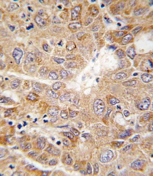 Polyclonal Rabbit anti-Human PGK1 / Phosphoglycerate Kinase Antibody (aa117-145, IHC, IF, WB)