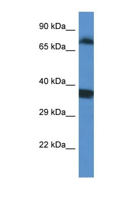 Polyclonal Rabbit anti-Human SRPK1 Antibody (aa399-448, WB)