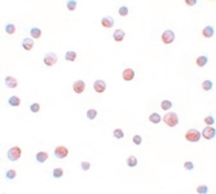 IHC-plus™ Polyclonal Rabbit anti-Human SIP1 Antibody (IHC, IF, WB)