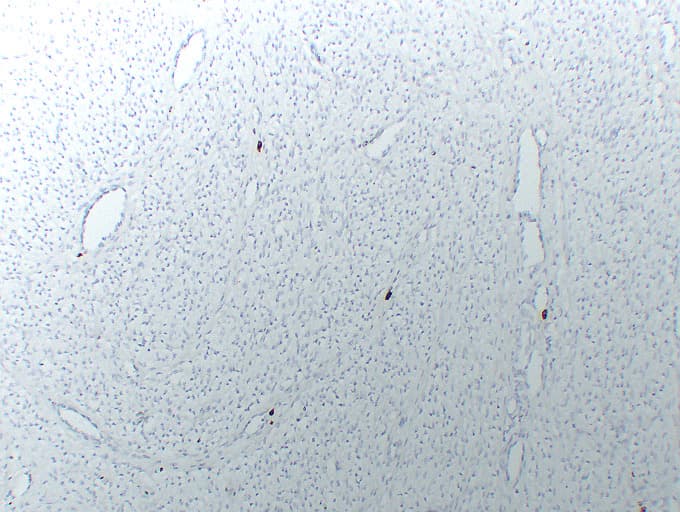 PathPlus™ Monoclonal Mouse anti-Human TPSAB1 / Mast Cell Tryptase Antibody (clone ABT-MCT, IHC)