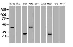 NOG / Noggin Antibody (clone OTI4C12)