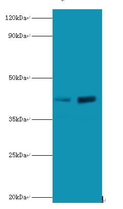 SSB / La Antibody