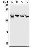 DDX20 / GEMIN3 Antibody