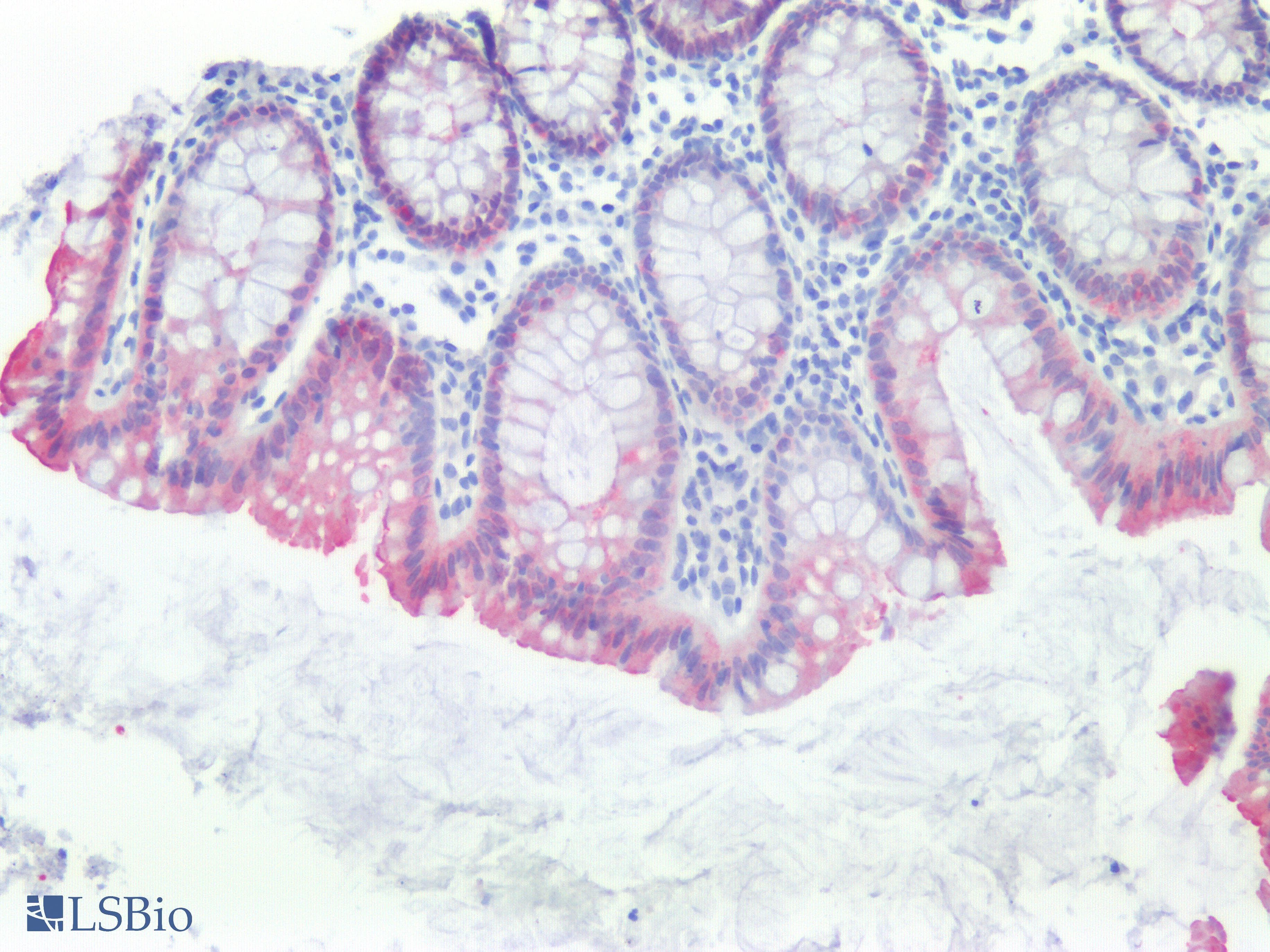 IHC-plus™ VIL1 / Villin Antibody (clone CWWB1)