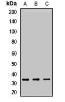 SDC1 / Syndecan 1 / CD138 Antibody