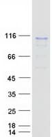 Human RSC1A1 Protein (Recombinant Myc-DDK (Flag))