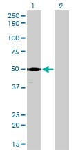 IHC-plus™ ACP2 / Acid Phosphatase 2 Antibody (clone M1-4A12)