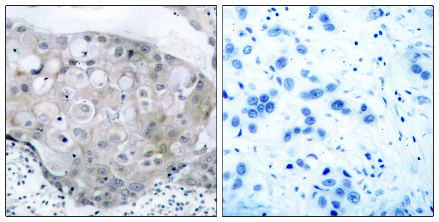 Polyclonal Rabbit anti-Human KDR / VEGFR2 / FLK1 Antibody (phospho-Tyr951, IHC, WB)