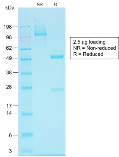 EPCAM Antibody (N-Terminus, aa 20-60, clone EGP40/1555R, Azide-free, Carrier-free)