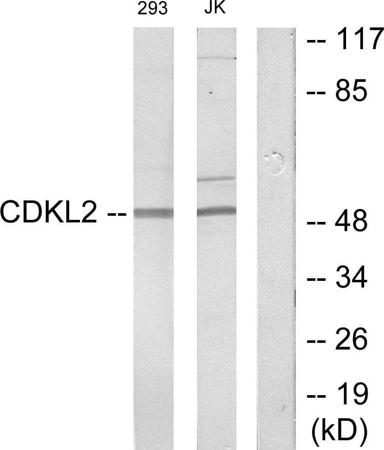 CDKL2 Antibody
