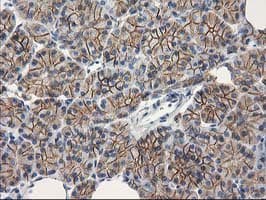 CTNNB1 / Beta Catenin Antibody (clone OTI1E10, Carrier-free)