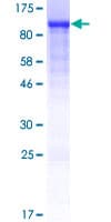 Human CALD1 / Caldesmon Protein (Recombinant GST)