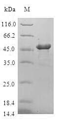 Human CRYGD / CCP Protein (Recombinant GST, N-terminus)