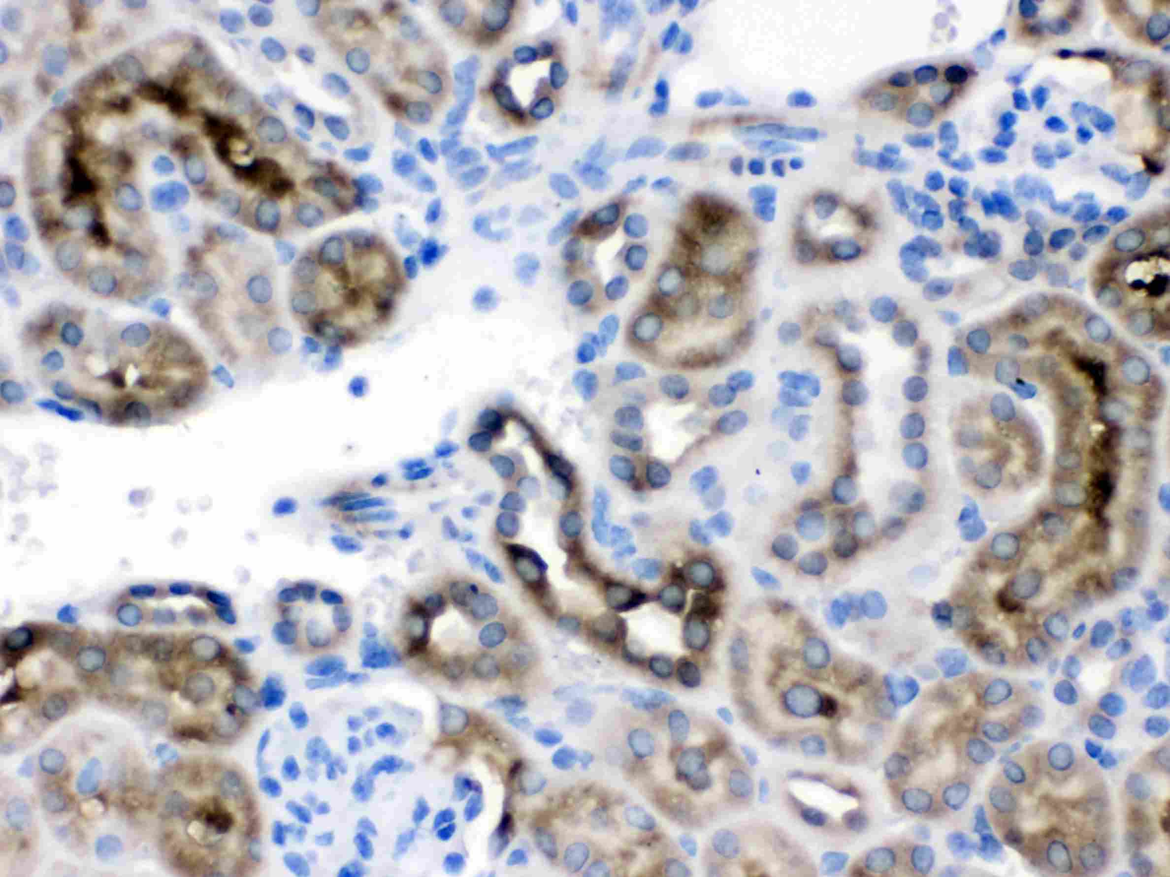 CCT4 / SRB Antibody